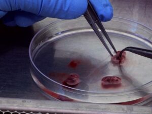 FDA Records Obtained By Judicial Watch Show Purchases of Fetal Organs, Heads and Tissue for ‘Humanized Mice’ Project