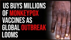 US Buys Millions Of MONKEYPOX Vaccines Amid Global Outbreak