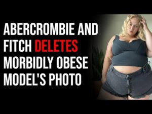 Abercrombie &amp; Fitch DELETES Mobidly Obese Model's Photo