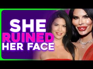 Lauren Sanchez's Extreme Plastic Surgery Horrifies The Internet