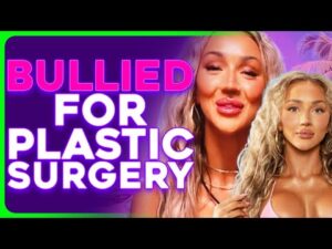 'Love Island USA' Contestant Vanna ROASTED For BOTCHED Cosmetic Work