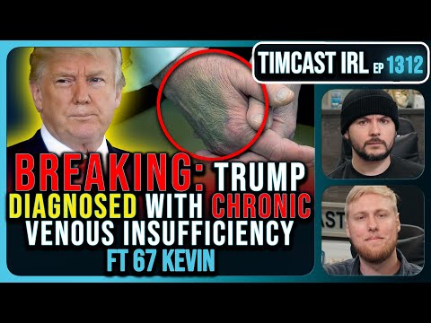 BREAKING: Trump Diagnosed With Chronic Vein Disease, Covers Bruised Hands With Make Up | Timcast IRL