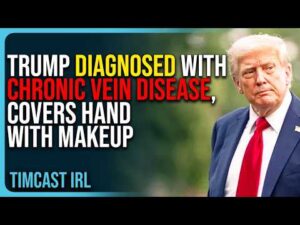 Trump DIAGNOSED With CHRONIC VEIN DISEASE, Covers Hand With Makeup
