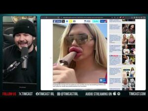 Plastic Surgery Trend Makes Women DISGUSTING, Young Women Look Horrible Following Creepy Trend